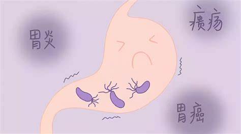 感染了幽门螺杆菌，一定要治疗吗？